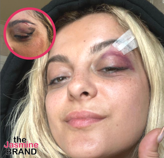 Update: Bebe Rexha Attacker Says He Hurled Phone At Singer’s Face Because He Felt ‘It Would Be Funny,’ Fan Charged w/ Assault & Aggravated Harassment